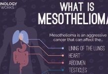 What is Mesothelioma Claim What is Mesothelioma Claim