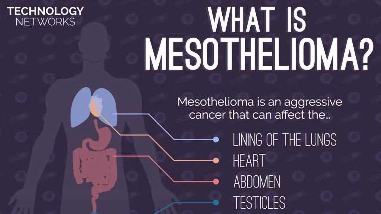 What is Mesothelioma Claim